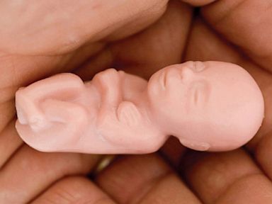 Children Receive Toy Fetuses at ND State Fair