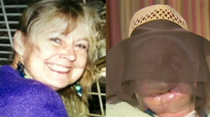 Charla Nash reveals her face on Oprah