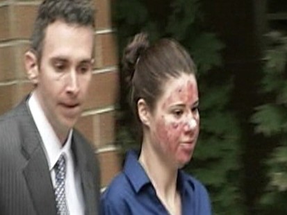 Video: Acid attack hoax girl pleads guilty.