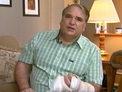 VIDEO: Bill Jordan tore skin and ligaments in his finger during the mall robbery.