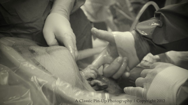 PHOTO: Baby Nevaeh Atkins holds Dr. Allan Sawyer's hand from inside her mother's womb.