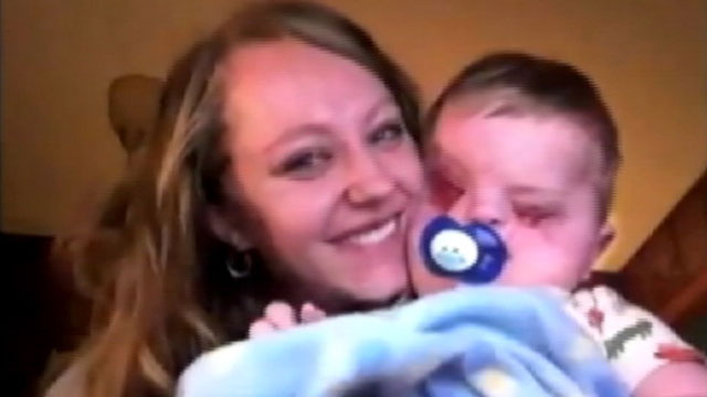 PHOTO: Lacey Buchanan's baby boy was born without eyes and with a cleft lip and palate.