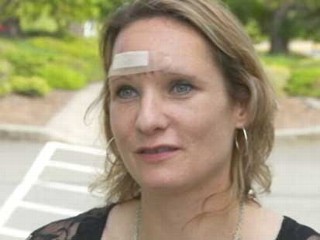 Woman Recovers From 200 Pole Splinters Through Windshield