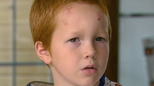 PHOTO: 8-year-old Kenny Markiewicz survived being swept into a Minnesota drain tunnel filled with rushing water and surfaced in a creek about a mile away