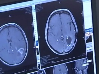 Watch: Cold Virus Targets Advanced Brian Cancer