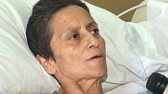 PHOTO: Maria Del Carmen Gomez, a victim of extreme domestic violence, is speaking out and warning other women not to wait around until its too late.