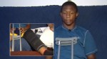 Video: High school football player stranded on the bench with a broken knee.