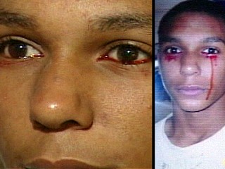 Could Teen's Tears Of Blood Be Stigmata?