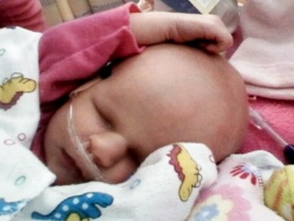 VIDEO: Baby Faiths rare condition