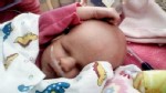 VIDEO: Baby Faith's rare condition