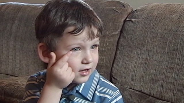 PHOTO: Four-year-old Jesse Matlock underwent surgery