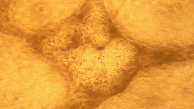 PHOTO: A look at "Nightline" anchor Bill Weirs pulsing cardiac tissue, developed from skin cells under his arm at the Mayo Clinic in Rochester, Minn.