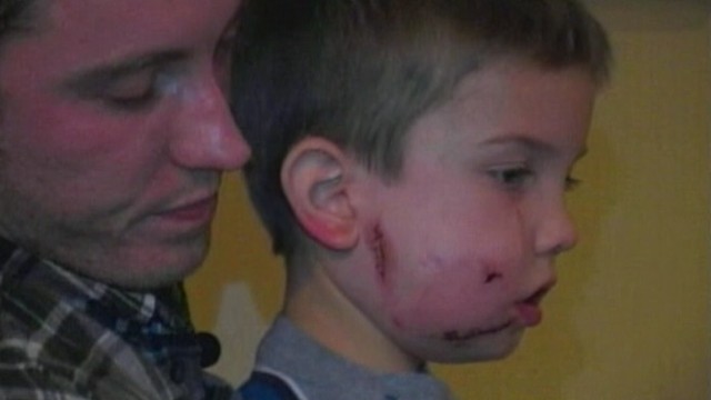 VIDEO: Family vacation to Big Bend National Park in Texas ends in the hospital.
