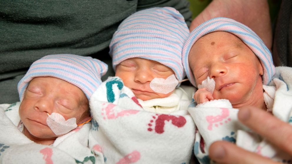 naturally-conceived-identical-triplets-born-in-sacramento-abc-news