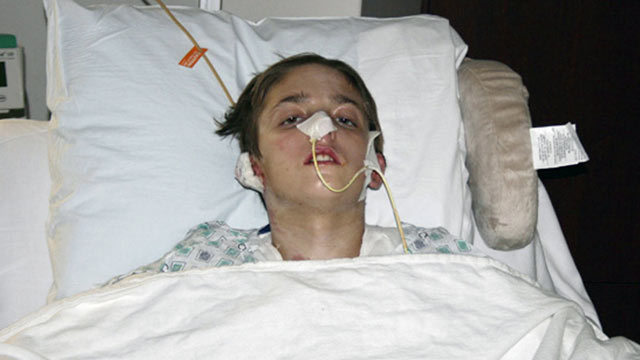 PHOTO: This undated file photo released by Jackson Health System on Nov. 24, 2009, shows Michael Brewer at Jackson Memorial Hospital in Miami recovering from severe burns.