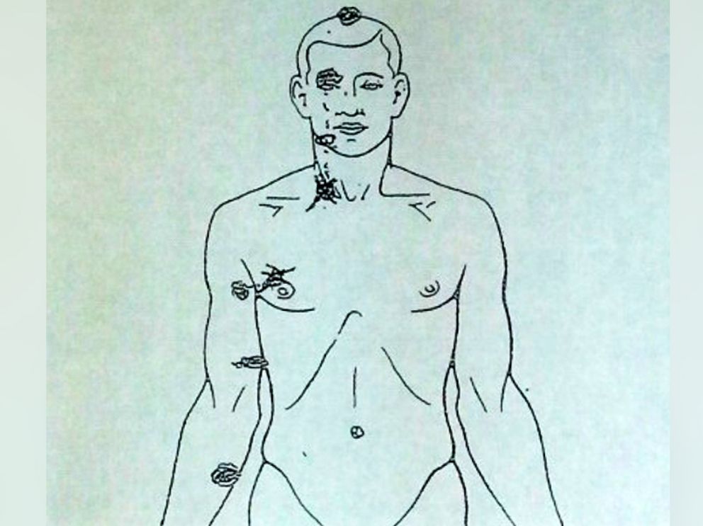 PHOTO: A diagram from a private autopsy, released Aug. 17, 2014, shows where Michael Brown, 18, was shot.