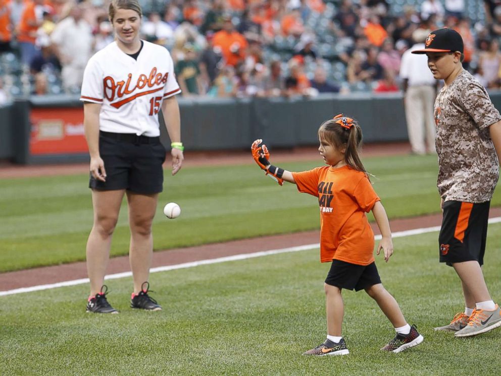 Girl with 3D prosthetic hand throws first pitch at World Series Girl with 3D prosthetic hand throws first pitch at World Series