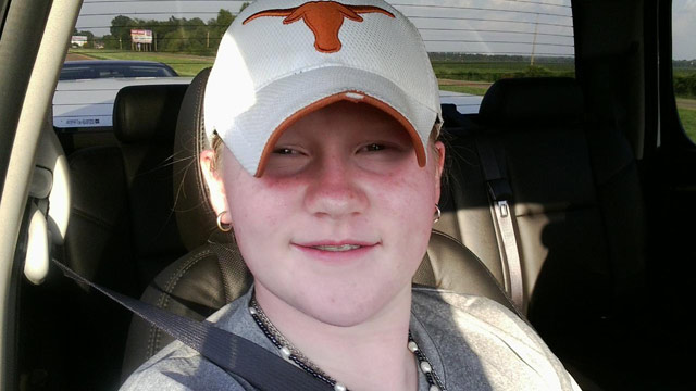 PHOTO: Elizabeth Robinson, 13, appears in this photo provided by her family.