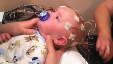 PHOTO: Nine month old month old Casen Buswell, has a genetic condition that hardens his blood vessels, skin and muscle.