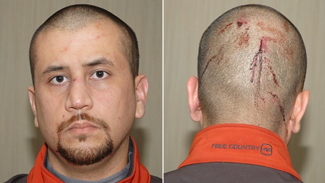 Cops, Witnesses Back Up George Zimmerman's Version - ABC News