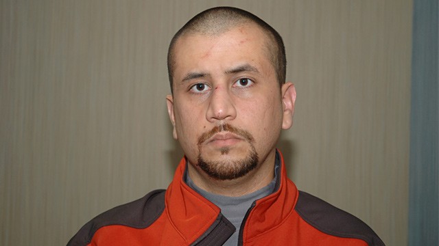 Lacerations are shown on the face of George Zimmerman, the ...