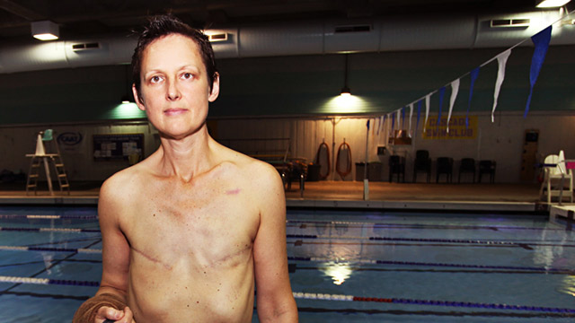 Seattle Breast Cancer Survivor Allowed To Swim Topless At City Pool