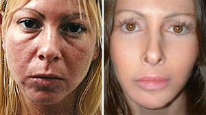 PHOTO Laura Pillarella underwent 15 plastic surgeries. Now, she says she regrets having them done.