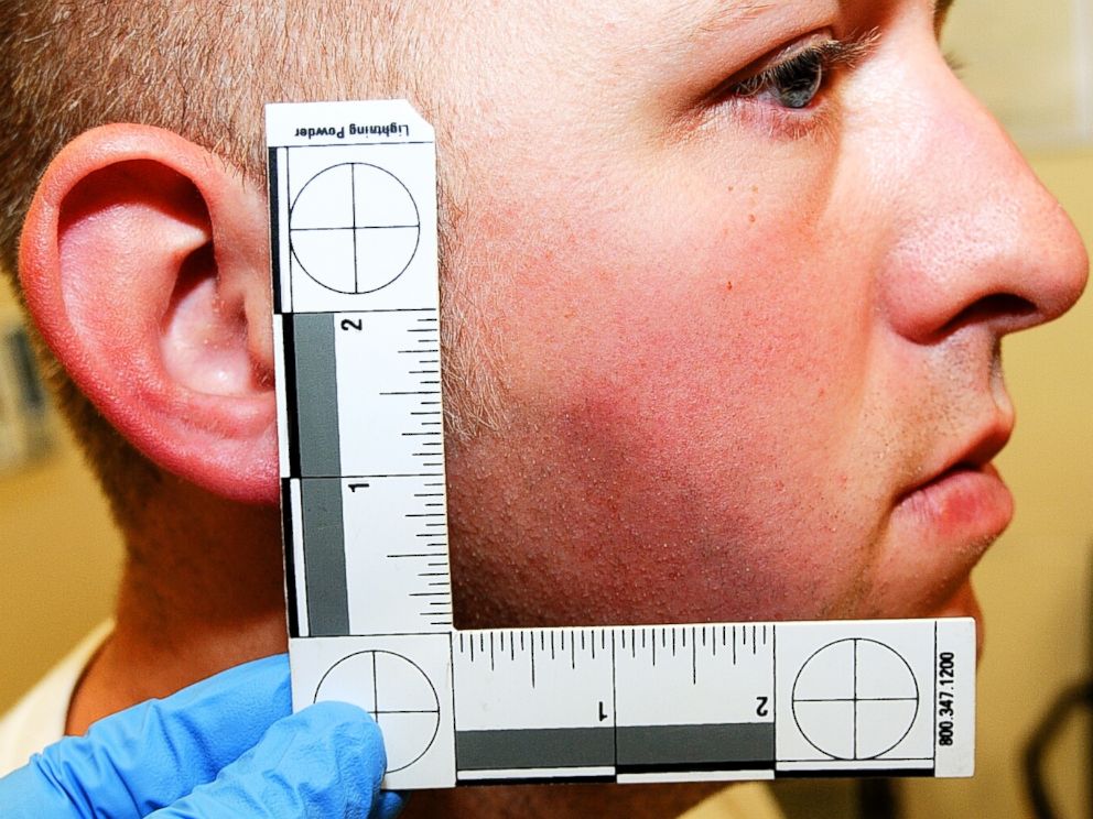 PHOTO: Ferguson, Mo. police officer Darren Wilson is pictured in evidence photos released by the St. Louis County Prosecutors Office on Nov. 24, 2014.