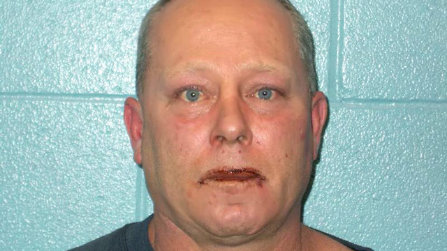 PHOTO: Mug shot of Roger Oates after allegedly biting the face of Ohio neighbor Scott Hall.