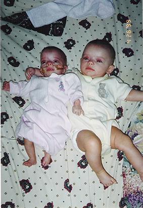 Are midget babies smaller images 476