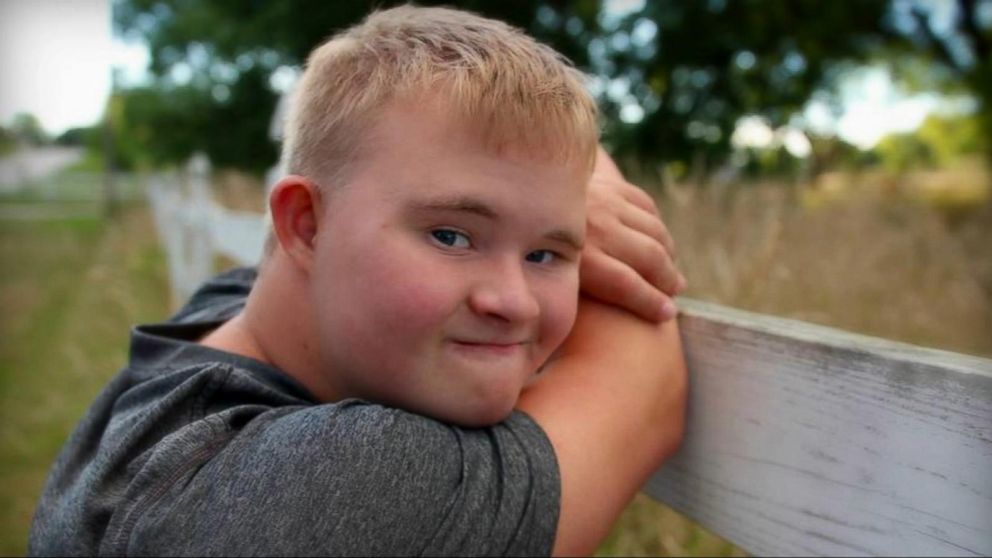 PHOTO: James Myer-Gerd, a senior with Down syndrome, hit a no-look, backward shot from half-court during halftime.