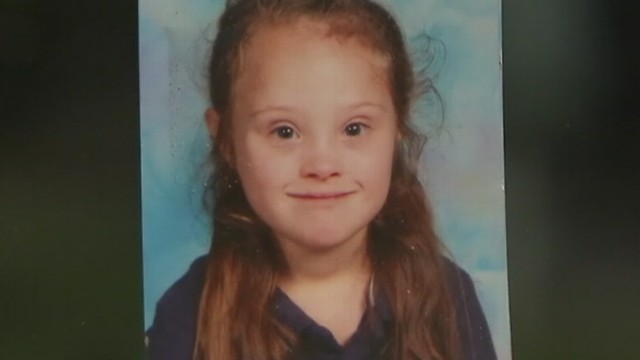 VIDEO: Mother of 7-year-old with Down syndrome says the school gave conflicting reasons for cutting the hair.