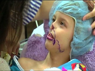 Mauling Victim Gets Surgery to Fix Nose