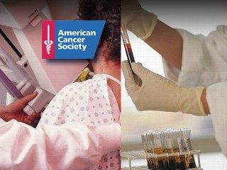 Cancer Society Catches Heat for Breast, Prostate Cancer Screening Criticism Top ACS Official's Statements on Some Cancer Tests Has Docs Locked in Debate