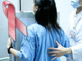 breast cancer