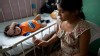 Rotavirus clinic