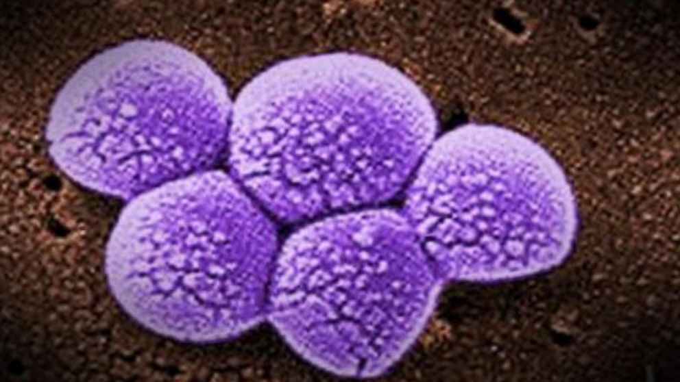 VIDEO: Germs on a Plane: Look What They Found on Board