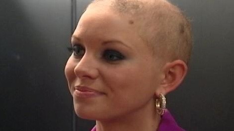VIDEO: Miss America contestant not letting hair loss stop her quest for the crown.