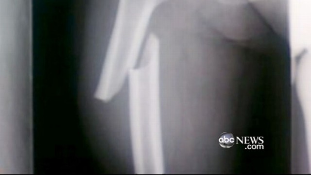 VIDEO: Dr. Richard Besser has information for those in need.