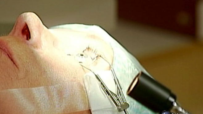 VIDEO: Artificial corneas may be the answer in the fight against blindness.