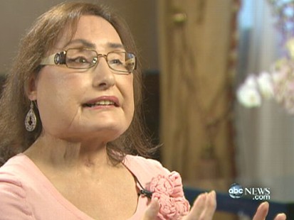 VIDEO: Connie Culp talks to Diane Sawyer about her recovery a year after her surgery.