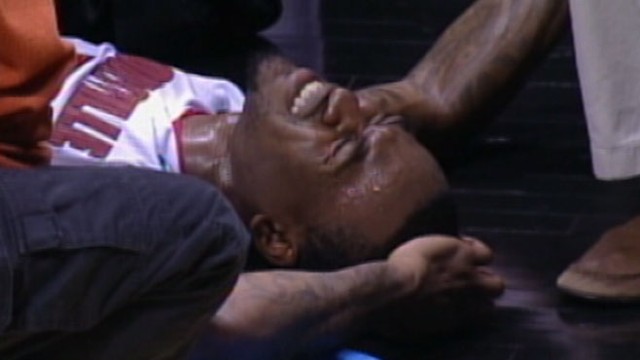 Louisville&#39;s Kevin Ware Has Surgery After Gruesome Tourney Injury - ABC News