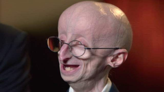 Video: The Triumphant Story of Sam Berns, Progeria and Math