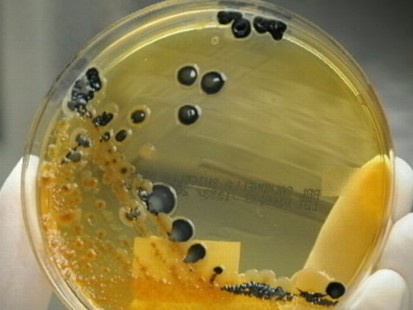VIDEO: The Dangers of Salmonella