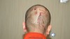 VIDEO: New evidence, including Trayvon Martin's autopsy, in George Zimmerman case.