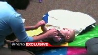 VIDEO: What does the pull-to-sit test in babies reveal about autism?