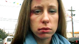 PHOTO What would you do, if in a public place, you saw a woman who showed unmistakable signs of physical abuse? Would you comfort her, call the police, or mind your own business?