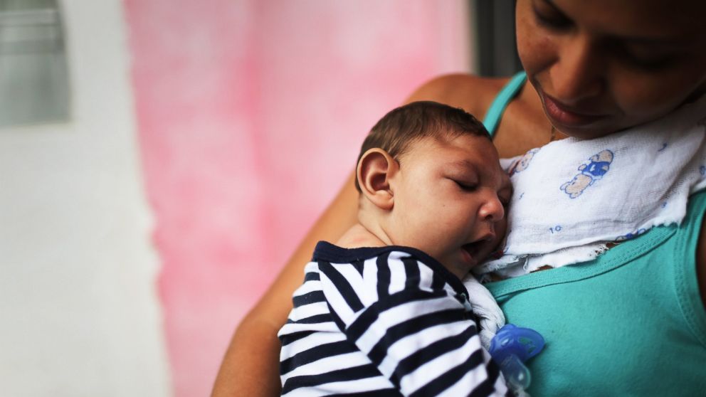 Zika in the US: How Doctors Help Infants With Microcephaly ...