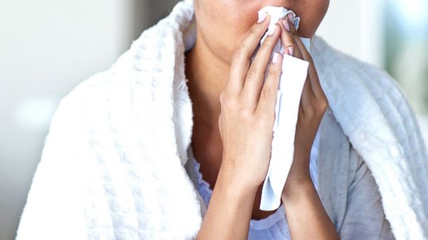 5 Things You Didn't Know About Allergies