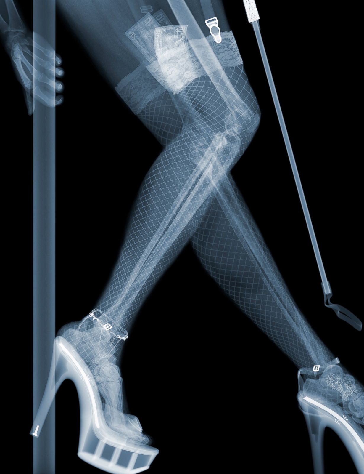 Stripper Picture | Nick Veasey's 'X-Ray Art' - ABC News